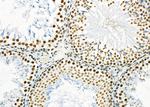 SFPQ Antibody in Immunohistochemistry (Paraffin) (IHC (P))