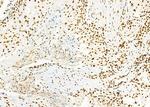 SFPQ Antibody in Immunohistochemistry (Paraffin) (IHC (P))