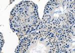 SMOX Antibody in Immunohistochemistry (Paraffin) (IHC (P))