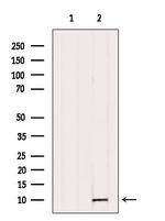 TNP1 Antibody in Western Blot (WB)