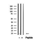 TNP1 Antibody in Western Blot (WB)