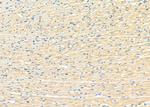 UQCRC1 Antibody in Immunohistochemistry (Paraffin) (IHC (P))