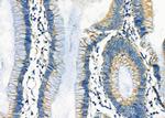 UQCRC1 Antibody in Immunohistochemistry (Paraffin) (IHC (P))