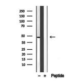 UQCRC1 Antibody in Western Blot (WB)