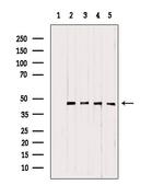 UQCRC1 Antibody in Western Blot (WB)