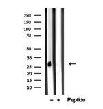 D4-GDI Antibody in Western Blot (WB)