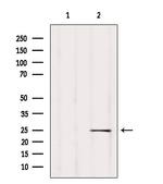 D4-GDI Antibody in Western Blot (WB)