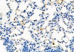 D4-GDI Antibody in Immunohistochemistry (Paraffin) (IHC (P))