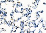 D4-GDI Antibody in Immunohistochemistry (Paraffin) (IHC (P))