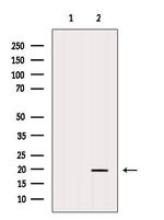 ARL6 Antibody in Western Blot (WB)