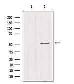 CALCOCO2 Antibody in Western Blot (WB)