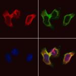 DIO1 Antibody in Immunocytochemistry (ICC/IF)