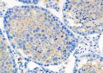 DIO1 Antibody in Immunohistochemistry (Paraffin) (IHC (P))