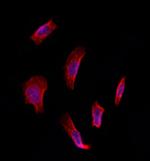 ETFDH Antibody in Immunocytochemistry (ICC/IF)