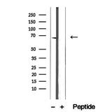 ETFDH Antibody in Western Blot (WB)