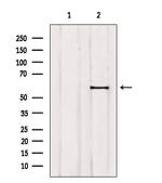 ETV5 Antibody in Western Blot (WB)