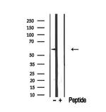 ETV5 Antibody in Western Blot (WB)