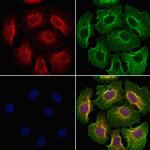 GSTM4 Antibody in Immunocytochemistry (ICC/IF)