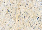 GSTM4 Antibody in Immunohistochemistry (Paraffin) (IHC (P))