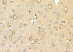 GSTM4 Antibody in Immunohistochemistry (Paraffin) (IHC (P))