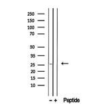 GSTM4 Antibody in Western Blot (WB)