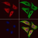 SLC39A6 Antibody in Immunocytochemistry (ICC/IF)