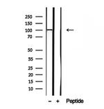 SLC39A6 Antibody in Western Blot (WB)