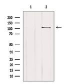 MTHFD1L Antibody in Western Blot (WB)