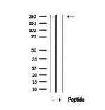 MYH6 Antibody in Western Blot (WB)