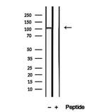 NAT10 Antibody in Western Blot (WB)