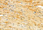 OPHN1 Antibody in Immunohistochemistry (Paraffin) (IHC (P))