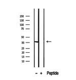 CRALBP Antibody in Western Blot (WB)