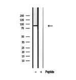 SEC63 Antibody in Western Blot (WB)