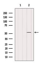 SHMT1 Antibody in Western Blot (WB)