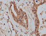 SLC25A46 Antibody in Immunohistochemistry (Paraffin) (IHC (P))