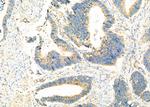 SLC25A46 Antibody in Immunohistochemistry (Paraffin) (IHC (P))