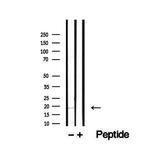 TMEM70 Antibody in Western Blot (WB)