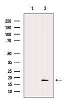 TMEM70 Antibody in Western Blot (WB)