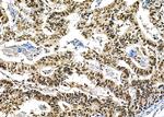 BCL9 Antibody in Immunohistochemistry (Paraffin) (IHC (P))