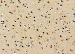 BCL9 Antibody in Immunohistochemistry (Paraffin) (IHC (P))