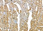 BCL9 Antibody in Immunohistochemistry (Paraffin) (IHC (P))