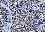 BCL9 Antibody in Immunohistochemistry (Paraffin) (IHC (P))