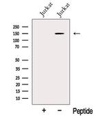 BCL9 Antibody in Western Blot (WB)