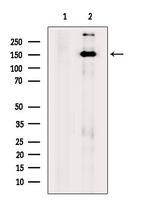 BCL9 Antibody in Western Blot (WB)