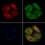 MMP24 Antibody in Immunocytochemistry (ICC/IF)