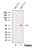 MMP24 Antibody in Western Blot (WB)