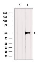 MMP24 Antibody in Western Blot (WB)