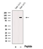 NUTM1 Antibody in Western Blot (WB)