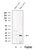 ADI1 Antibody in Western Blot (WB)