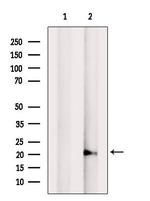 ADI1 Antibody in Western Blot (WB)